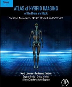 Atlas of Hybrid Imaging Sectional Anatomy for PET/CT, PET/MRI and SPECT/CT Vol. 1: Brain and Neck: Sectional Anatomy for PET/CT, PET/MRI and SPECT/CT (PDF)