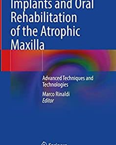 Implants and Oral Rehabilitation of the Atrophic Maxilla: Advanced Techniques and Technologies (PDF)