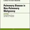 Pulmonary Complications of Non-Pulmonary Malignancy, An Issue of Clinics in Chest Medicine (Volume 38-2) (The Clinics: Internal Medicine, Volume 38-2) (PDF)