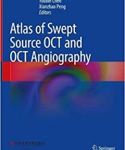 Atlas of Swept Source OCT and OCT Angiography (PDF)