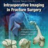 Illustrated Tips and Tricks for Intraoperative Imaging in Fracture Surgery (EPUB)