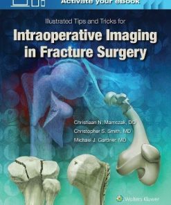 Illustrated Tips and Tricks for Intraoperative Imaging in Fracture Surgery (EPUB)