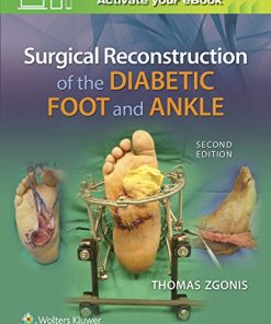 Surgical Reconstruction of the Diabetic Foot and Ankle, 2nd Edition (EPUB)