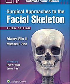 Surgical Approaches to the Facial Skeleton, 3rd Edition (EPUB)