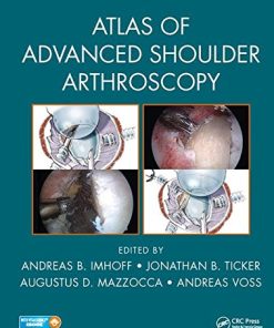 Atlas of Advanced Shoulder Arthroscopy (EPUB)