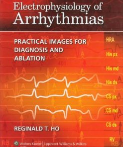 Electrophysiology of Arrhythmias: Practical Images for Diagnosis and Ablation (EPUB)