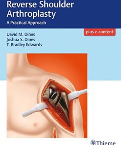 Reverse Shoulder Arthroplasty: A Practical Approach (PDF)