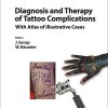 Diagnosis and Therapy of Tattoo Complications: With Atlas of Illustrative Cases (Current Problems in Dermatology, Vol. 52) (PDF)