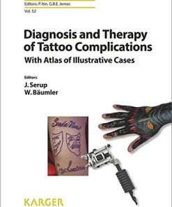 Diagnosis and Therapy of Tattoo Complications: With Atlas of Illustrative Cases (Current Problems in Dermatology, Vol. 52) (PDF)