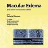 Macular Edema (Developments in Ophthalmology, Vol. 58) (PDF)