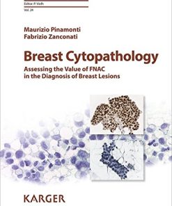 Breast Cytopathology: Assessing the Value of FNAC in the Diagnosis of Breast Lesions (Monographs in Clinical Cytology, Vol. 24) (PDF)