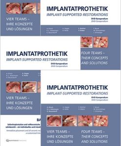 Implant-Supported Restorations – Vol. 1- 4 – (Video Course)