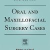 Oral and Maxillofacial Surgery Cases PDF