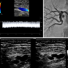 ASE Registered Physician in Vascular Interpretation (RPVI) Online Review Course 2023