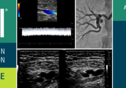 ASE Registered Physician in Vascular Interpretation (RPVI) Online Review Course 2023