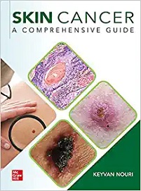 Skin Cancer: A Comprehensive Guide (EPUB)