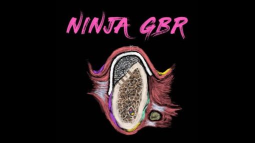 Implant Ninja GBR – Guided Bone Regeneration