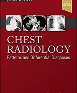 Chest Radiology: Patterns and Differential Diagnoses, 7th Edition (PDF)