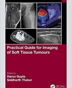 Practical Guide for Imaging of Soft Tissue Tumours (EPUB)