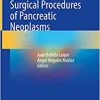 Recent Innovations in Surgical Procedures of Pancreatic Neoplasms (EPUB)