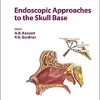 Endoscopic Approaches to the Skull Base (Progress in Neurological Surgery, Vol. 26) (EPUB)