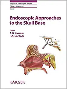 Endoscopic Approaches to the Skull Base (Progress in Neurological Surgery, Vol. 26) (EPUB)