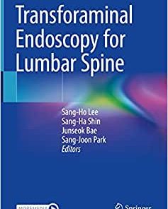 Transforaminal Endoscopy for Lumbar Spine (PDF)