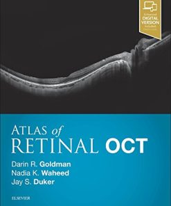 Atlas of Retinal OCT: Optical Coherence Tomography, 1e (PDF)