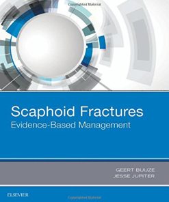 Scaphoid Fractures: Evidence-Based Management, 1e (PDF)