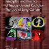 Principles and Practice of Image-Guided Radiation Therapy of Lung Cancer (PDF)