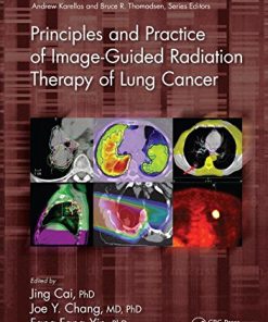 Principles and Practice of Image-Guided Radiation Therapy of Lung Cancer (PDF)