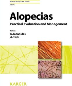 Alopecias – Practical Evaluation and Management (Current Problems in Dermatology Book 47) 1st Edition (PDF)