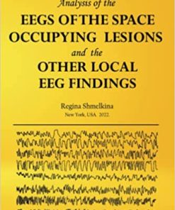 Analysis of the EEGs of the Space- occupying Lesions and the Other Local EEG Findings (EPUB)