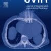 Journal of Vascular and Interventional Radiology PDF