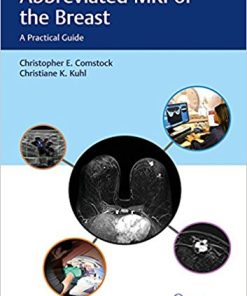 Abbreviated MRI of the Breast: A Practical Guide (PDF)