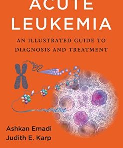 Acute Leukemia: An Illustrated Guide to Diagnosis and Treatment (PDF)