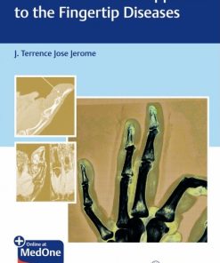 An Evidence-Based Approach To The Fingertip Diseases (PDF)