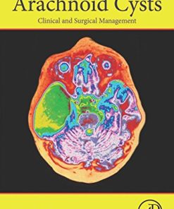 Arachnoid Cysts: Clinical and Surgical Management (PDF)