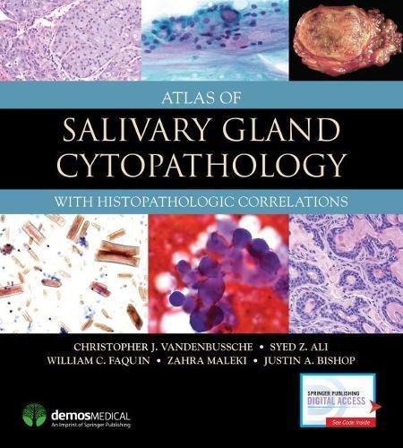 Atlas of Salivary Gland Cytopathology: with Histopathologic Correlations (PDF) Atlas of Salivary Gland Cytopathology: with Histopathologic Correlations (PDF)