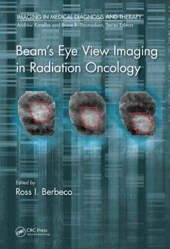 Beam’s Eye View Imaging in Radiation Oncology (PDF) Beam’s Eye View Imaging in Radiation Oncology (PDF)