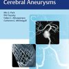 Brain Arteriovenous Malformations and Arteriovenous Fistulas (PDF)