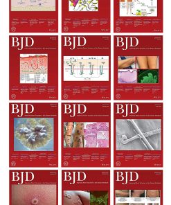 British Journal of Dermatology 2022 Full Archives (PDF)