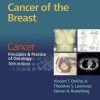 Cancer: Principles & amp; Practice of Oncology: Cancer of the Breast (EPUB)