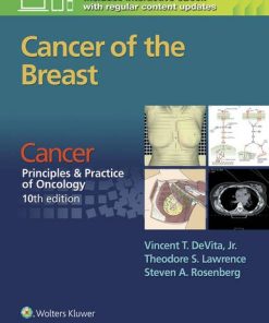 Cancer: Principles & amp; Practice of Oncology: Cancer of the Breast (EPUB)