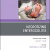 Necrotizing Enterocolitis, An Issue of Clinics in Perinatology (Volume 46-1) (The Clinics: Orthopedics, Volume 46-1) (PDF)