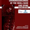 Chordomas and Chondrosarcomas of the Skull Base and Spine, Second Edition (PDF)