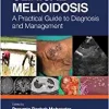 Clinical Melioidosis: A Practical Guide to Diagnosis and Management (EPUB)