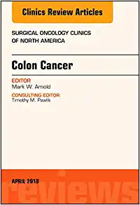 Colon Cancer, An Issue of Surgical Oncology Clinics of North America (Volume 27-2) (The Clinics: Surgery, Volume 27-2) (PDF) Colon Cancer, An Issue of Surgical Oncology Clinics of North America (Volume 27-2) (The Clinics: Surgery, Volume 27-2) (PDF)