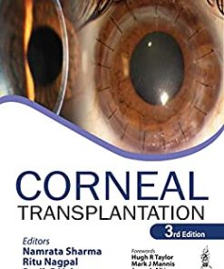 Corneal Transplantation, 3rd edition (PDF)
