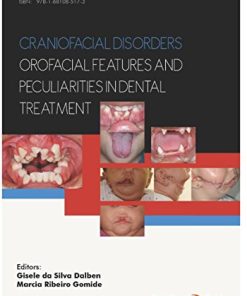 Craniofacial disorders – orofacial features and peculiarities in dental treatment (PDF)